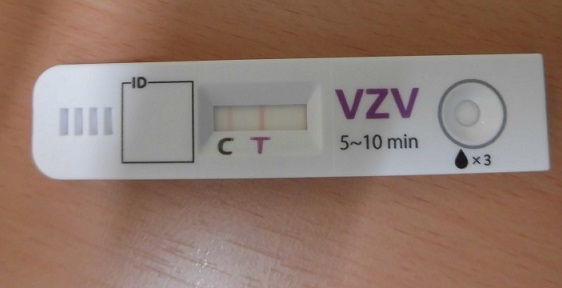 夏だ！レジャーだ！虫刺されは受診だ！