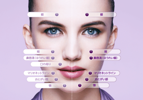 しわができやすい部位