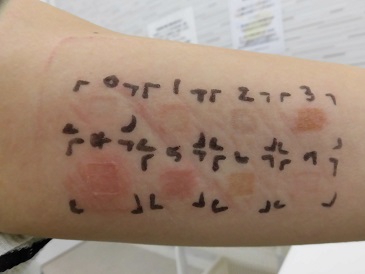 金属アレルギー　パッチテスト