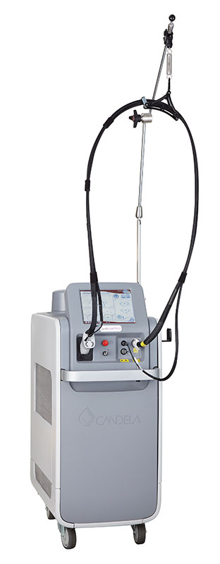 ジェントルマックスプロ