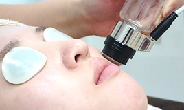 エレクトロポレーション