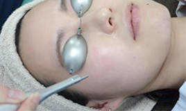 レーザーピーリング