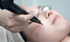 レーザートーニング