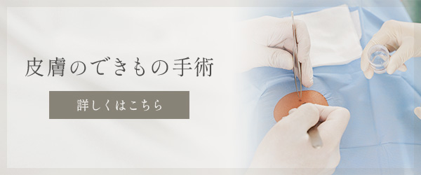 皮膚のできもの手術