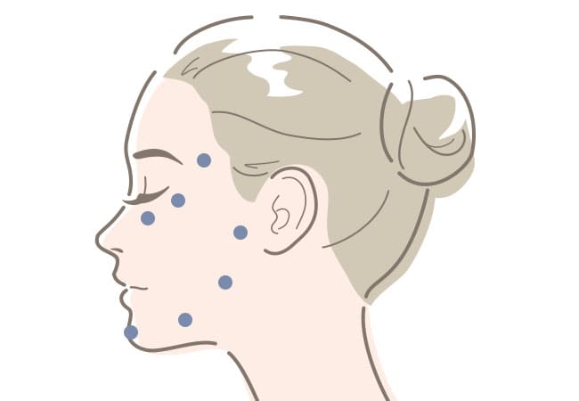 注射部位のイメージ